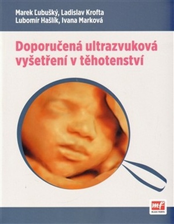 Doporučená ultrazvuková vyšetření v těhotenství