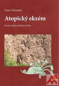 Atopický ekzém. Patofyziológia, klinika a liečba