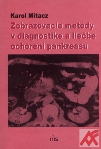 Zobrazovacie metódy v diagnostike a liečbe ochorení pankreasu