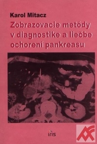 Zobrazovacie metódy v diagnostike a liečbe ochorení pankreasu