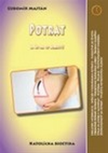 Potrat. A čo na to cirkev?