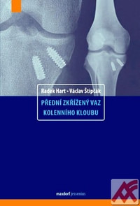Přední zkřížený vaz kolenního kloubu