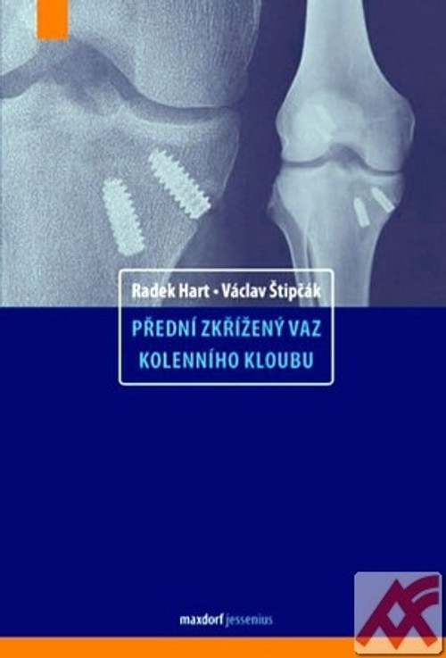 Přední zkřížený vaz kolenního kloubu