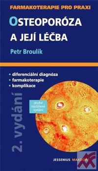 Osteoporóza a její léčba