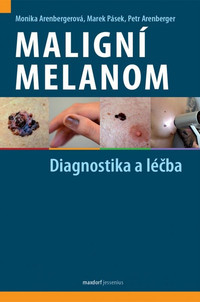 Maligní melanom. Diagnostika a léčba