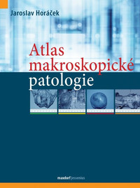 Atlas makroskopické patologie