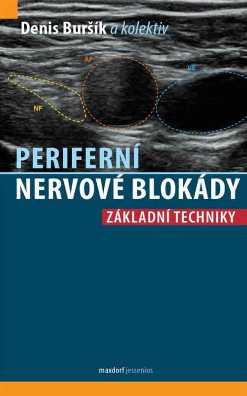 Periferní nervové blokády