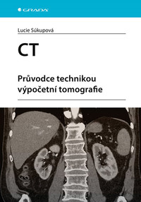CT - Průvodce technikou výpočetní tomografie