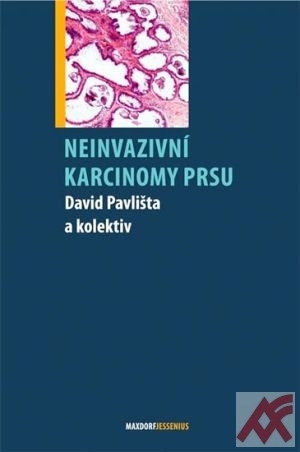 Neinvazivní karcinomy prsu