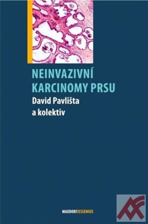 Neinvazivní karcinomy prsu