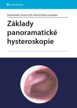 Kniha Základy panoramatické hysteroskopie