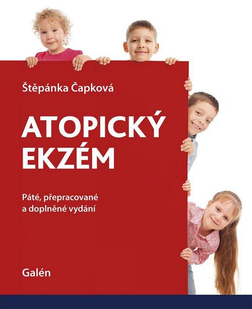 Atopický ekzém