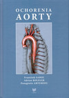 Ochorenia aorty
