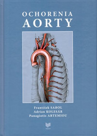 Ochorenia aorty