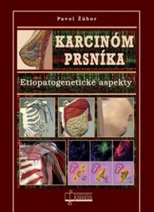 Karcinóm prsníka. Etiopatogenetické aspekty