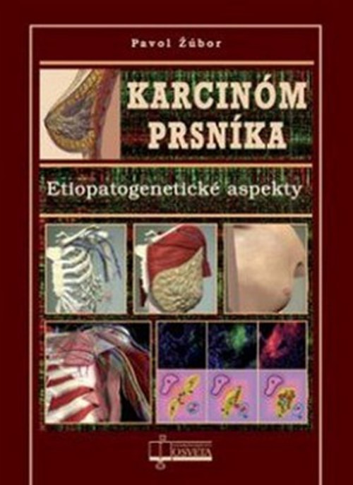 Karcinóm prsníka. Etiopatogenetické aspekty