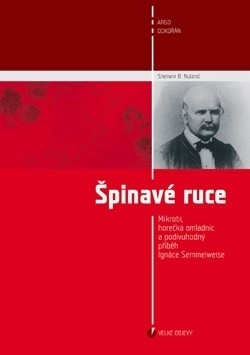 Špinavé ruce