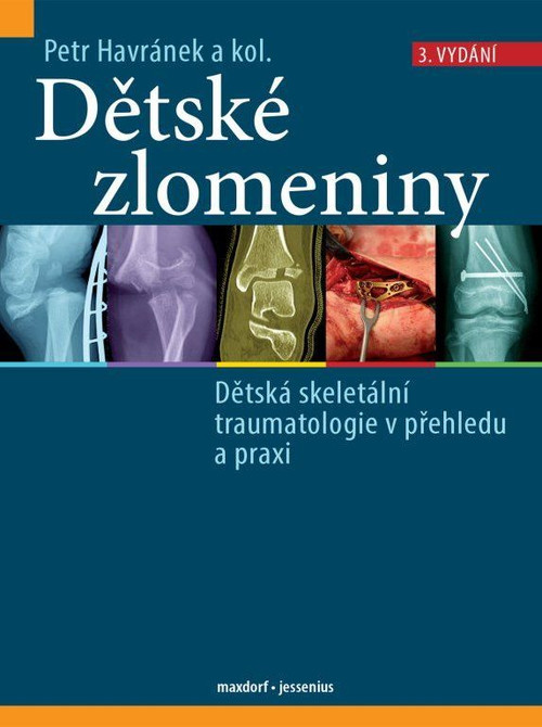 Dětské zlomeniny