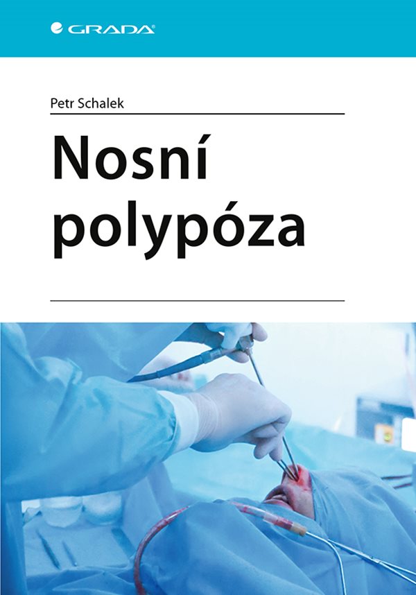 Nosní polypóza