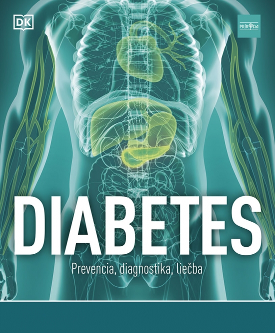 Diabetes. Prevencia, diagnostika, liečba