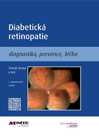 Diabetická retinopatie