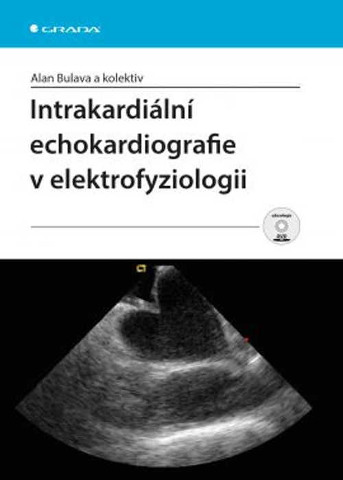 Intrakardiální echokardiografie v elektrofyziologii + DVD