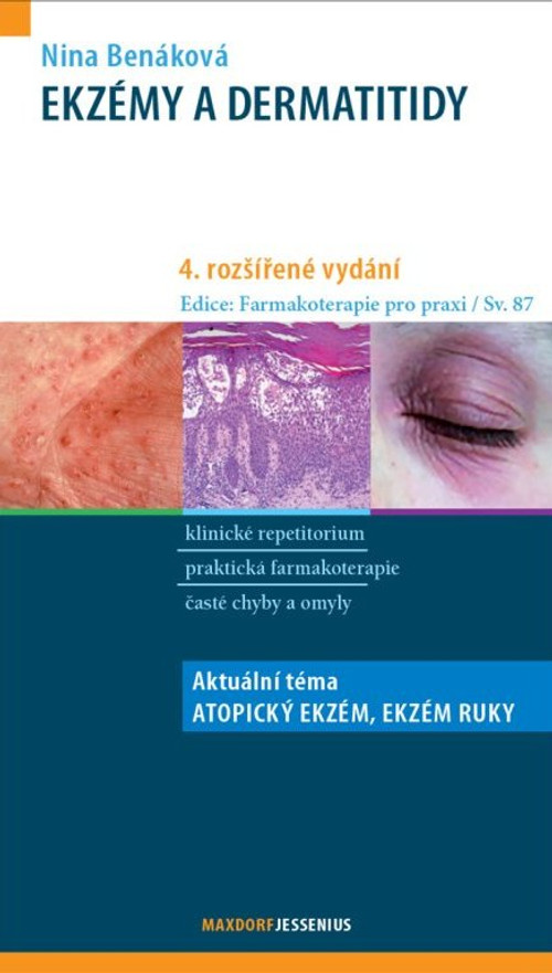 Ekzémy a dermatitidy