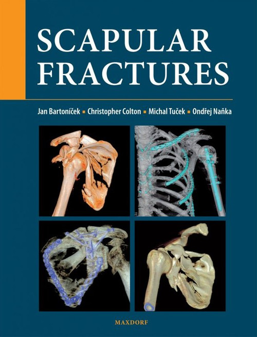 Scapular fractures