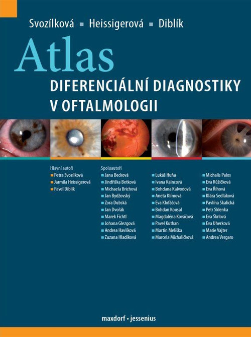 Atlas diferenciální diagnostiky v oftalmologii