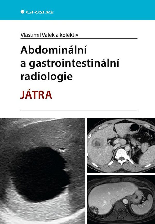 Abdominální a gastrointestinální radiologie