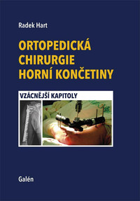 Ortopedická chirurgie horní končetiny