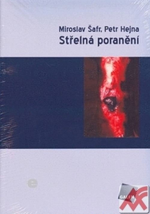 Střelná poranění