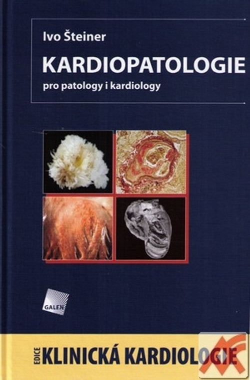 Kardiopatologie