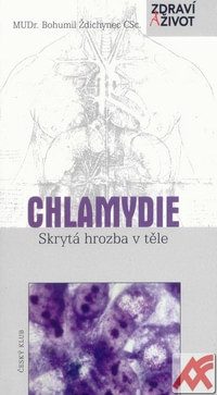 Chlamydie. Skrytá hrozba v těle