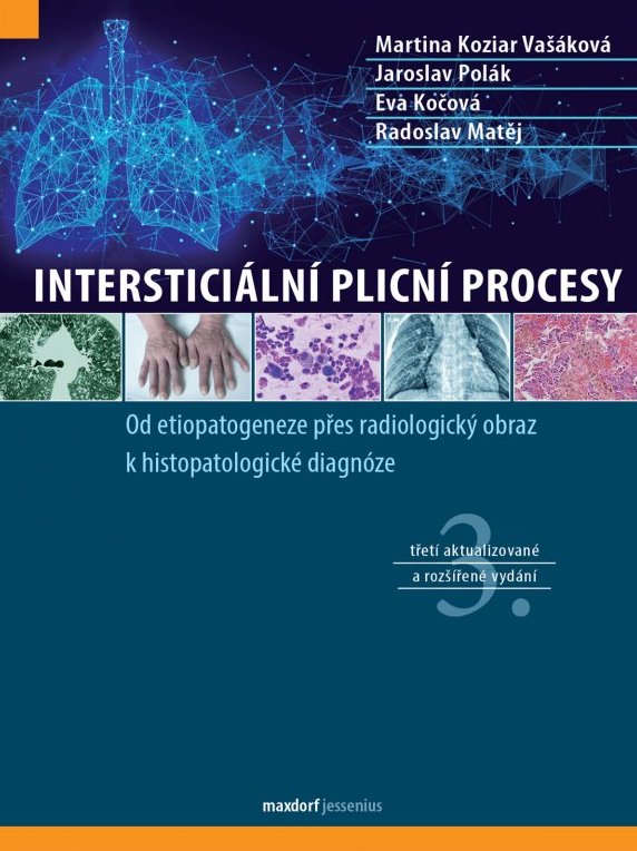 Intersticiální plicní procesy