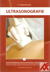 Ultrasonografie